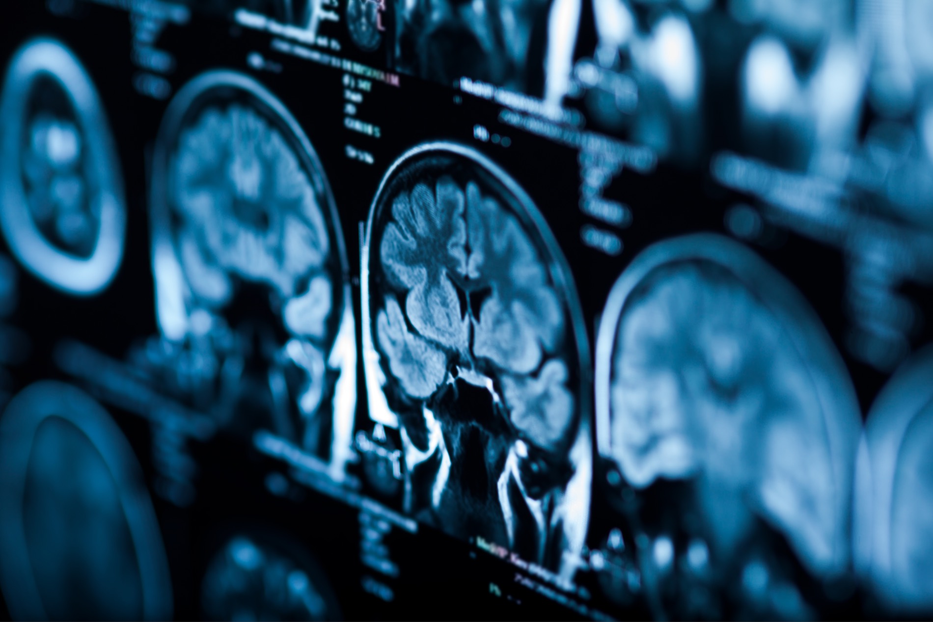 RT- Magnetic Resonance Imaging