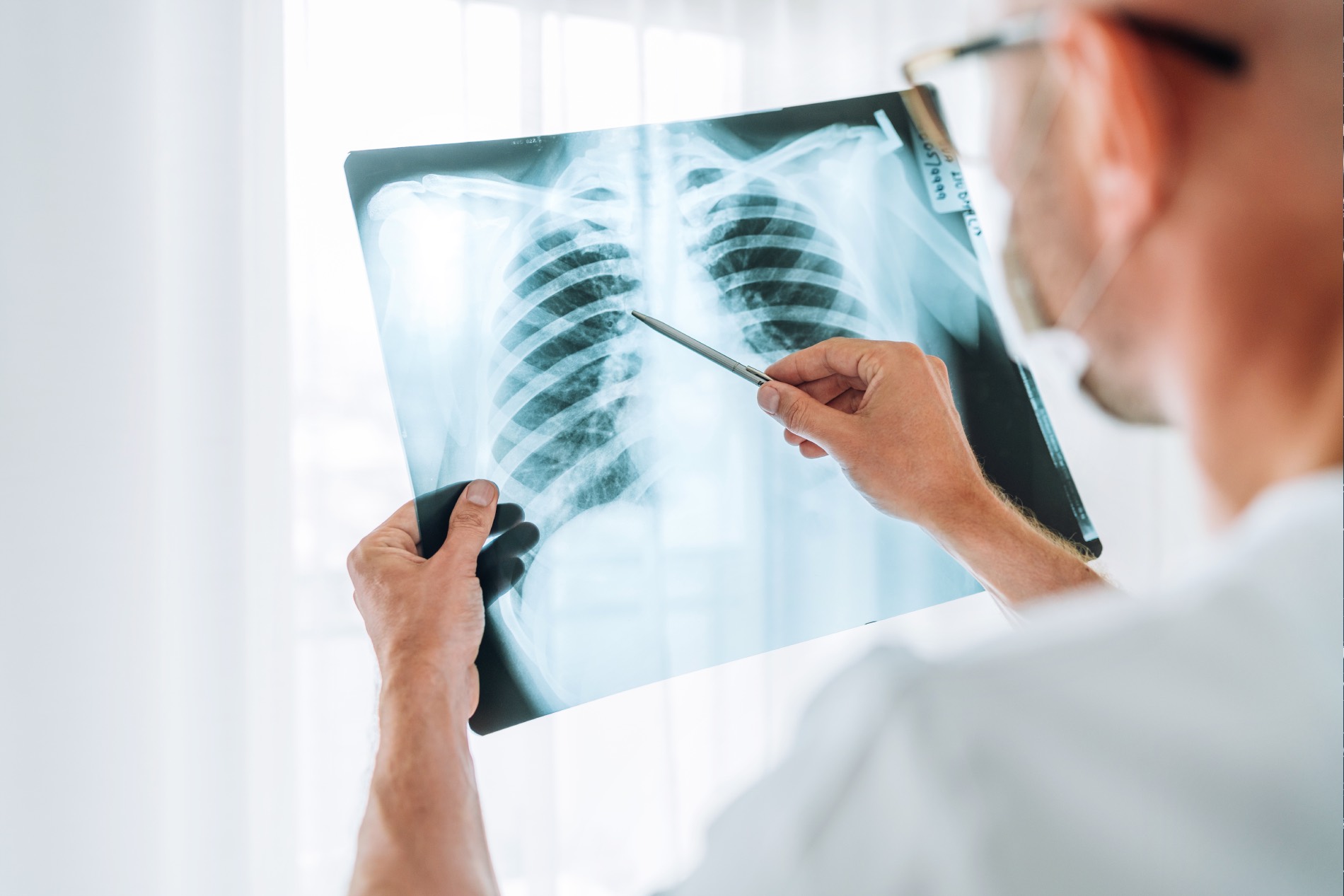 RT- X-Ray