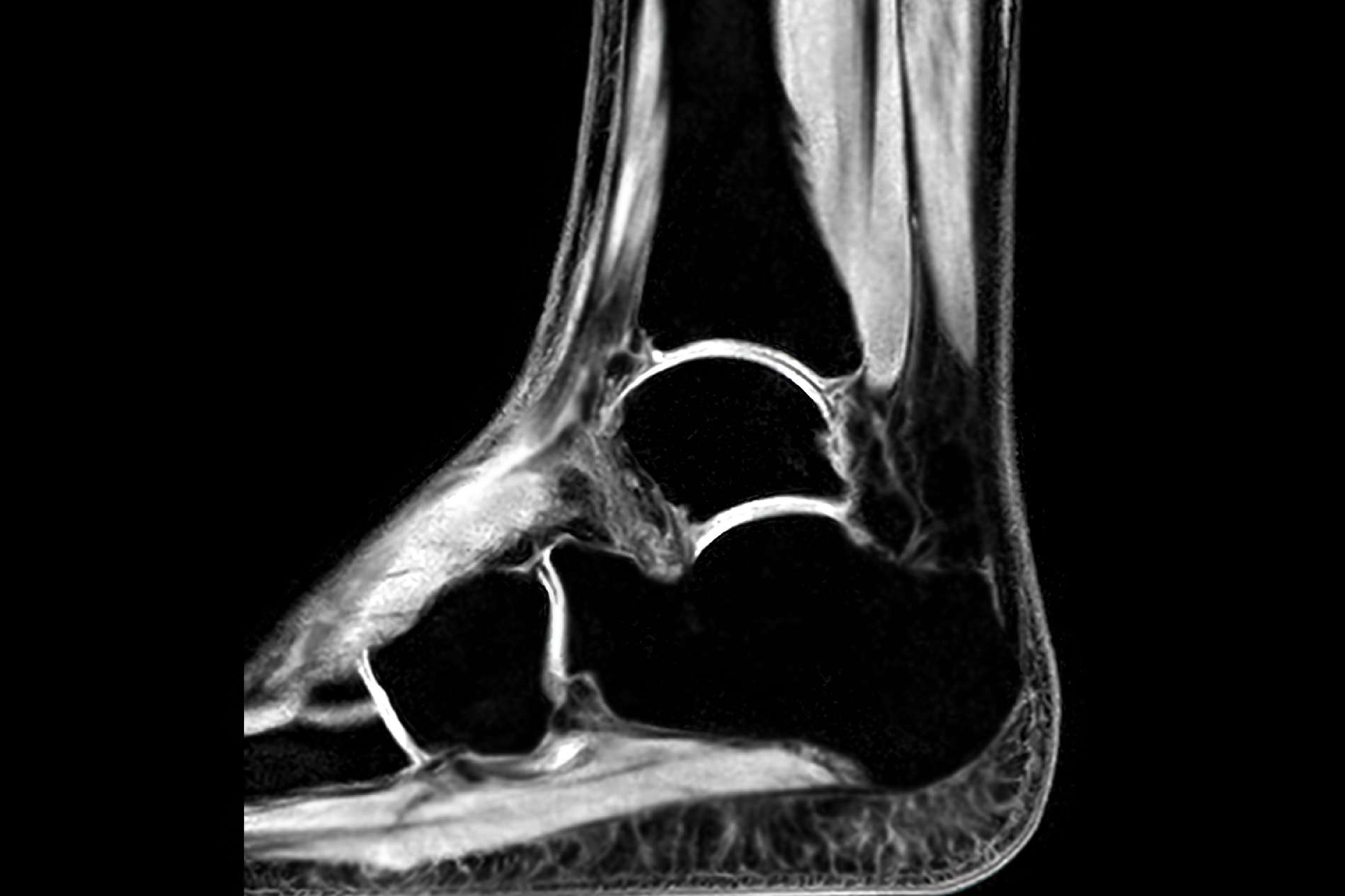 Medical Radiology - MSK