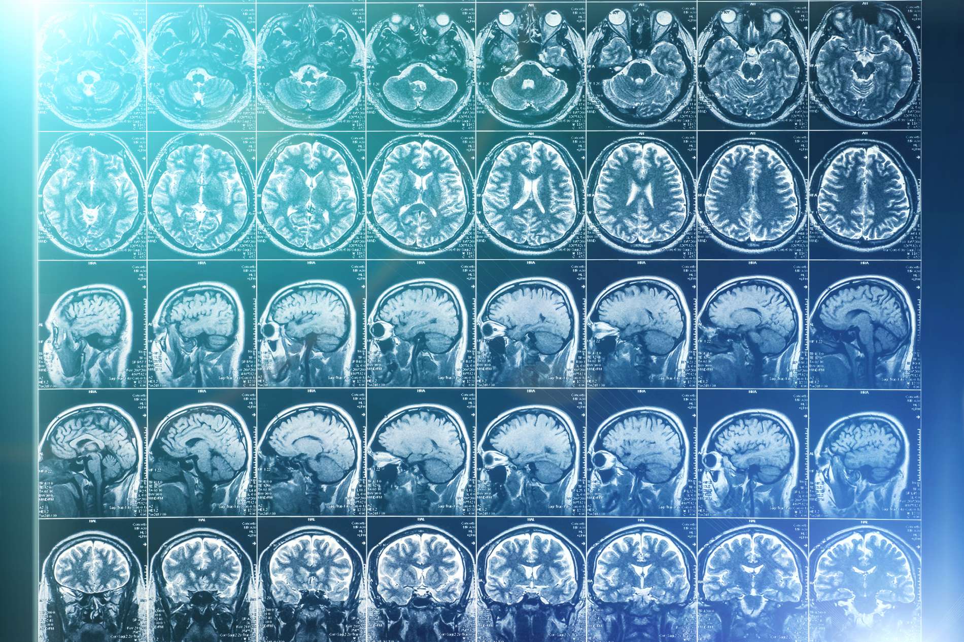 Medical Radiology  - Neuroradiology 